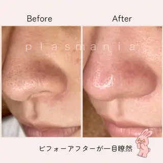 肌管理エステサロン| Connect ゆいのエステ・リラクイメージ