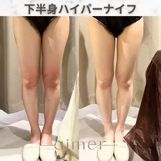 aimer服部 /  小顔 ・ 痩身のその他イメージ
