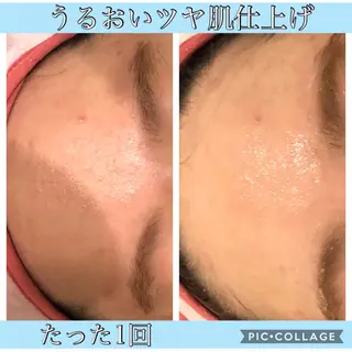 ロング カラー パーマ ヘアアレンジ キッズ ネイル マツエク・マツパ EnsorClair 代表 野口真央のエステ・リラクイメージ