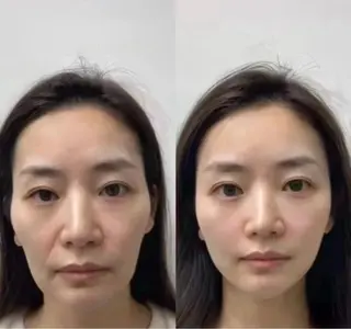 ショート 愛維美水光専門店 川崎彩鳳のエステ・リラクイメージ