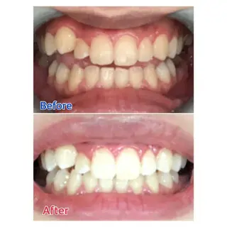 Melty 輝のその他イメージ