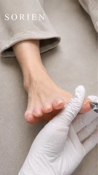 フットケア 巻き爪のネイルデザイン