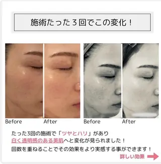 ﾌｧｯｼｮﾆｽﾀ🫧 ｴｽﾃ/hidemiのエステ・リラクイメージ