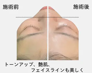 パーソナルサロン iley【アイリー】のエステ・リラクイメージ