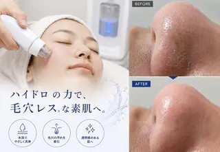 メンズ モエ ｜青葉台 脱毛のエステ・リラクイメージ