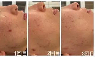 佐藤 加奈のエステ・リラクイメージ