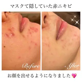 ダイエット・美肌ケア fleurのエステ・リラクイメージ