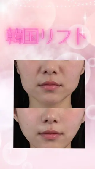 マツエク・マツパ 愛維美水光専門店 川崎彩鳳のエステ・リラクイメージ