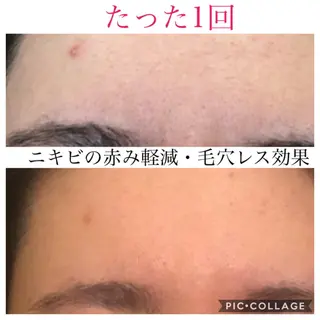 ショート カラー パーマ ヘアアレンジ キッズ ネイル マツエク・マツパ EnsorClair 代表 野口真央のエステ・リラクイメージ