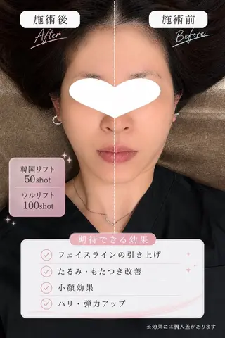マツエク・マツパ 愛維美水光専門店 川崎彩鳳のエステ・リラクイメージ