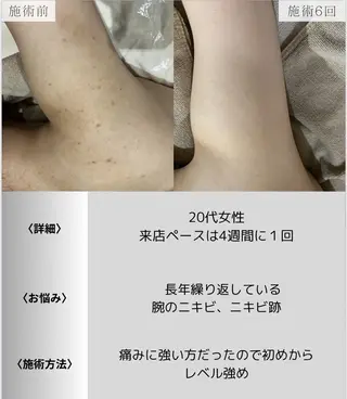 脱毛・眉毛・フェイス サロンN久留米店の眉毛・アイブロウイメージ