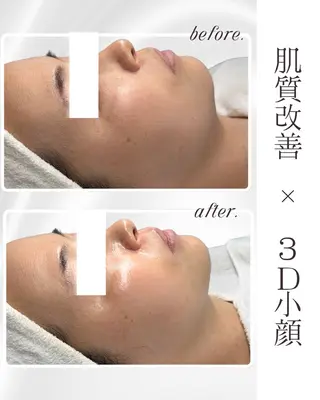 LiAm《韓国管理/ 小顔/脂肪ケア》のエステ・リラクイメージ