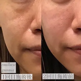 emiluca西目/ 脱毛/細胞美容のエステ・リラクイメージ