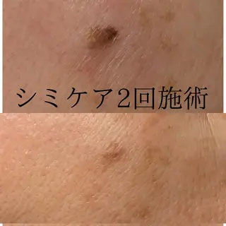 プライベートサロン プリュネルのエステ・リラクイメージ
