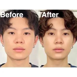 メンズ 隆鼻矯正専門店ラプリ 高橋のエステ・リラクイメージ