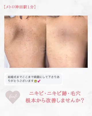 小顔/毛穴/ニキビ salon bealのエステ・リラクイメージ