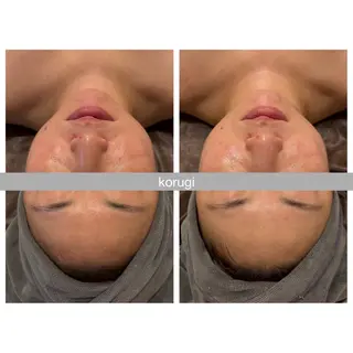 表参道エステ痩身 hiromiのエステ・リラクイメージ