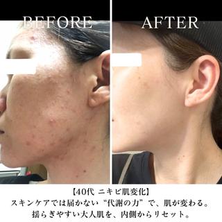 YOSAPARK urara大井町のエステ・リラクイメージ