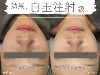 エステ&ヘアー ALPHA PLUSのエステ・リラクイメージ