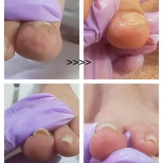 ネイル ネイルサロン AlmondEyeのネイルデザイン