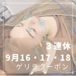 即効⚡小顔美容鍼🪡 むくみたるみケア鍼!のエステ・リラクイメージ