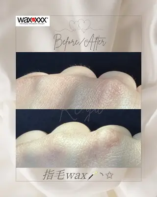 Re:yu┃wax 脱毛┃糸島市のエステ・リラクイメージ