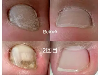 ネイル Nagi  Nail 本山のネイルデザイン