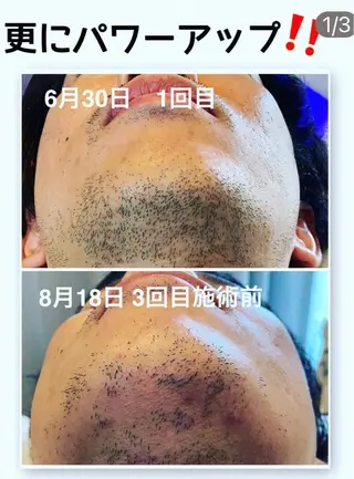脱毛サロン mamanaのエステ・リラクイメージ