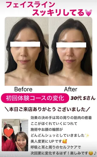小顔サロン (ラ リュミエール)のエステ・リラクイメージ