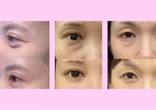 マツエク・マツパ 愛維美水光美肌専門店 メンズレディースokのエステ・リラクイメージ