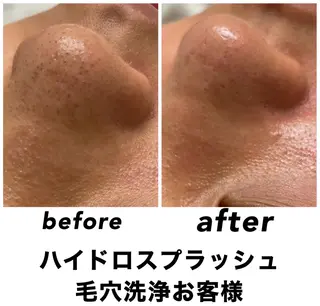 ネイル・エステサロン UILANIのエステ・リラクイメージ