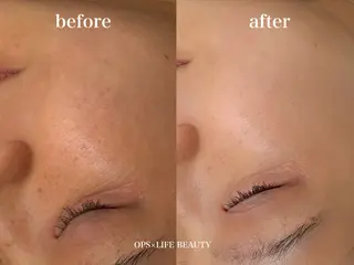 OPS×LIFE BEAUTY/maiのエステ・リラクイメージ