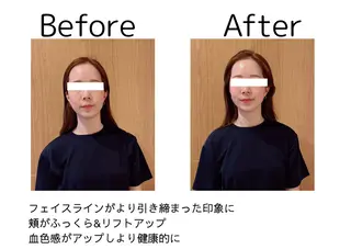 鍼灸師 NARUMIのエステ・リラクイメージ