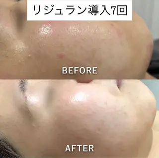 エステティックサロン Viveのエステ・リラクイメージ