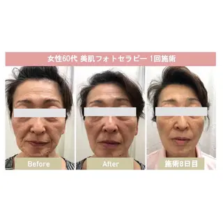 美肌脱毛i |泉大津のエステ・リラクイメージ