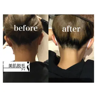 美肌脱毛i |泉大津のエステ・リラクイメージ