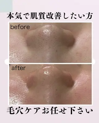 肌質改善サロン facialmoonのエステ・リラクイメージ