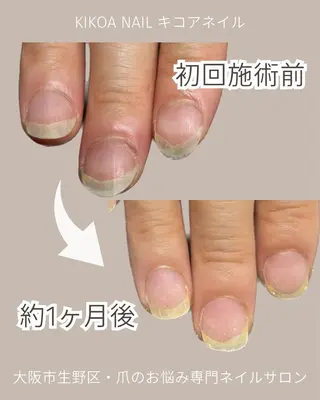 ネイル KIKOA NAIL キコアネイルのネイルデザイン