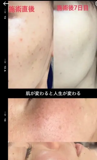 SPOT.com  シミケア専門店のエステ・リラクイメージ