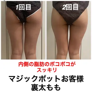 ネイル・エステサロン UILANIのエステ・リラクイメージ