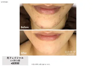メディカルサロンド オフ🧸YUSAのエステ・リラクイメージ