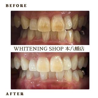 メンズ ホワイトニング ショップ本八幡店のエステ・リラクイメージ