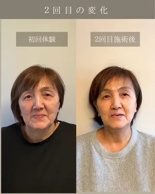美肌&小顔矯正 Noelieのエステ・リラクイメージ