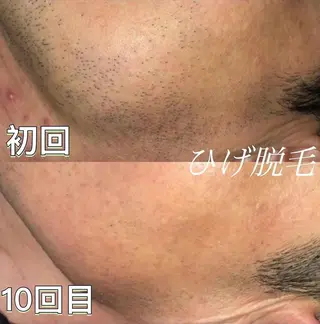 emiluca西目/ 脱毛/細胞美容のエステ・リラクイメージ