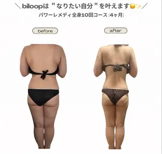 《本気痩せ×疲労改善 》  BILOOPのエステ・リラクイメージ