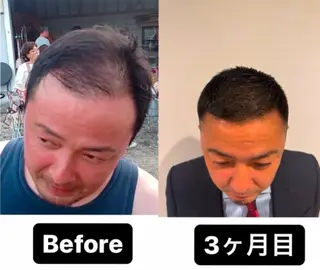 髪の再生請負人 矢野雄三のヘアスタイル
