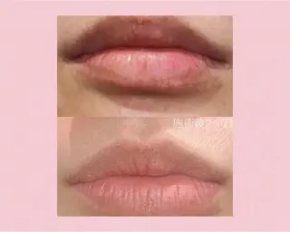 メンズ脱毛サロン BRIGHTのエステ・リラクイメージ