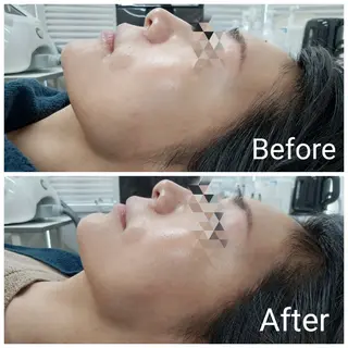 肌質改善Beauty salon Renのエステ・リラクイメージ