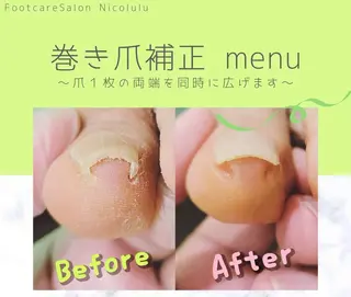 メンズ Nicolulu 金沢店のエステ・リラクイメージ