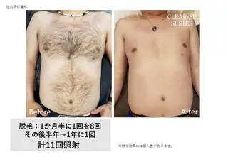 メンズ TOTALCLEAR TAOKAのエステ・リラクイメージ